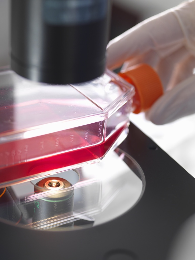 CHO-K1/ B7-H4 Stable Cell Line